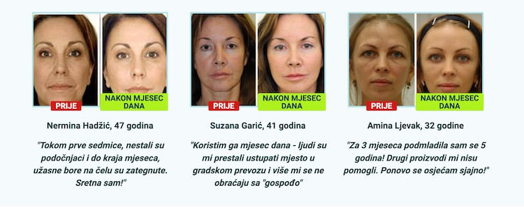 biolift krema iskustva